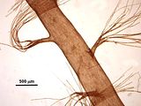 5 – Dettaglio delle pseudolaterali